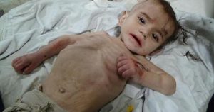 krisis-kebuluran-di-madaya